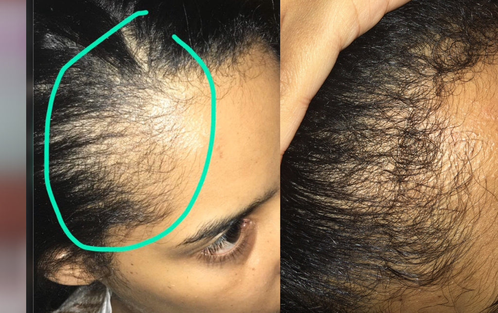 DOREA 15 DIAS "Oferta hasta agotar el  STOCK" ❤️‍🔥15 bolsas de té + Aceite Capilar